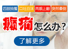 成都有治女性癫痫病的医院吗